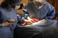 Large Teratoma is surgically removed from a patient at DVSC-Grapevine